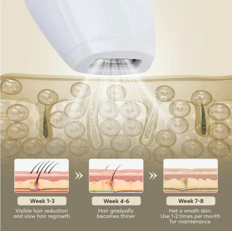 Épilateur laser professionnel IPL, épilation du corps, du maillot, des jambes, 900 000 flashs, 5 niveaux, épilateur électrique indolore