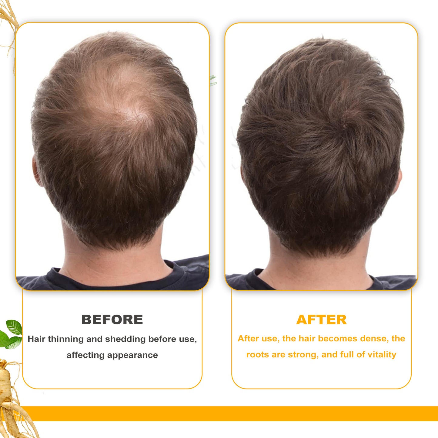 Huile de soin capillaire à la biotine EELHOE, soin de massage du cuir chevelu profondément hydratant, huile de soin pour cheveux épais et lisses