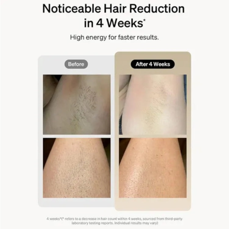 Épilateur laser professionnel IPL, épilation du corps, du maillot, des jambes, 900 000 flashs, 5 niveaux, épilateur électrique indolore
