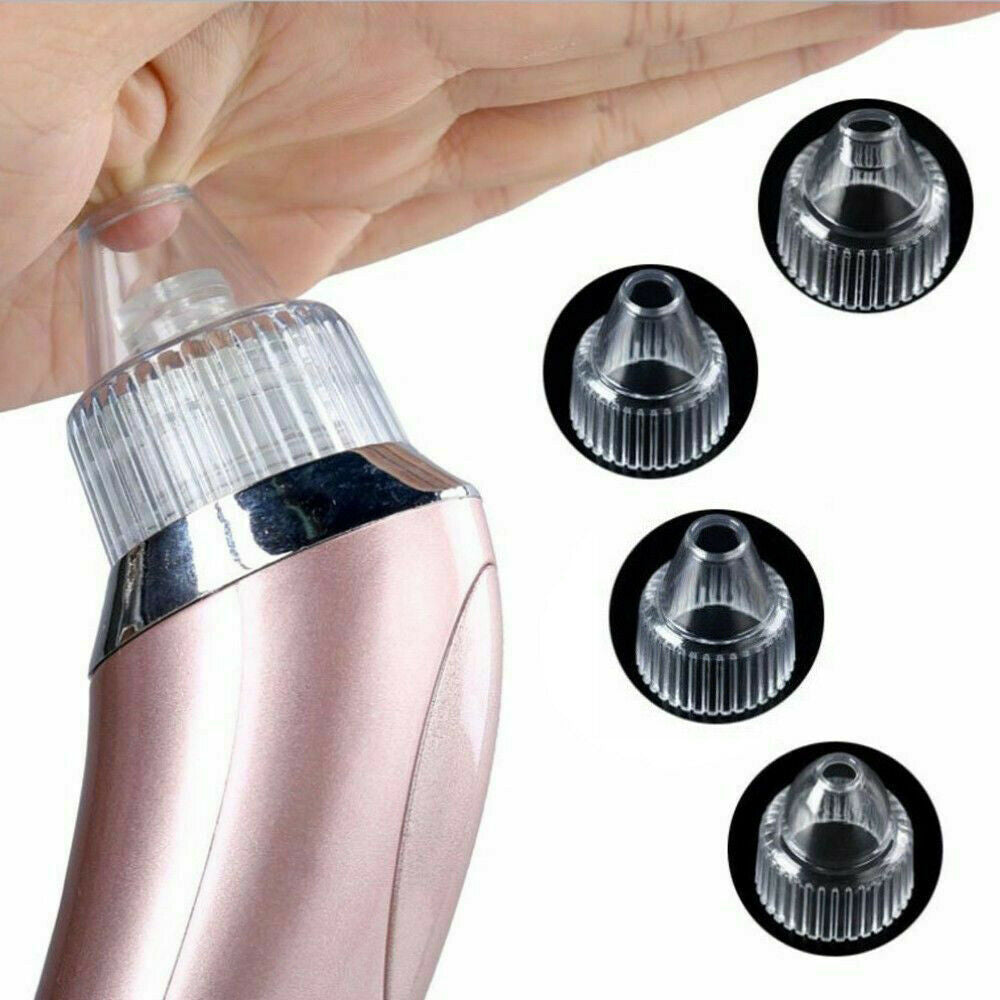 Aspirateur électrique pour points noirs et pores, élimine l'acné et les boutons, outil d'aspiration puissant, élimine les points noirs et les pores, dermabrasion au diamant, nettoyant pour le visage