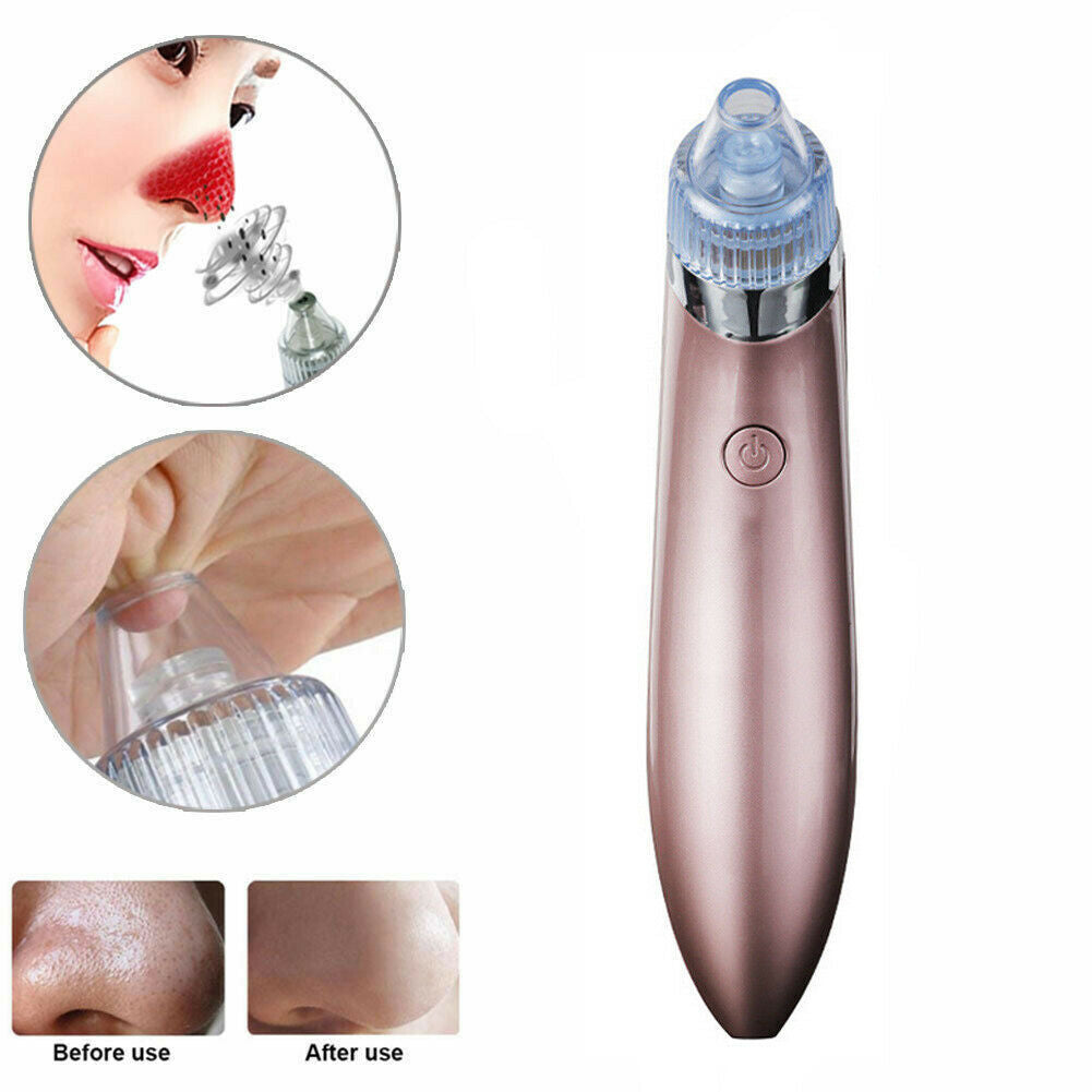 Aspirateur électrique pour points noirs et pores, élimine l'acné et les boutons, outil d'aspiration puissant, élimine les points noirs et les pores, dermabrasion au diamant, nettoyant pour le visage