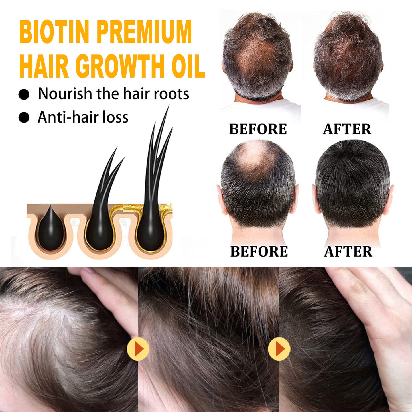 Huile de soin capillaire à la biotine EELHOE, soin de massage du cuir chevelu profondément hydratant, huile de soin pour cheveux épais et lisses